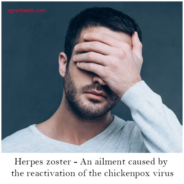 Behandlung Herpes Zoster
